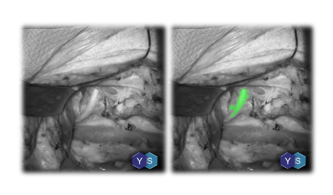 PRECISION MEDICINE PLATFORM